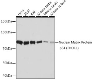 Nuclear Matrix Protein p84 (THOC1) Rabbit mAb