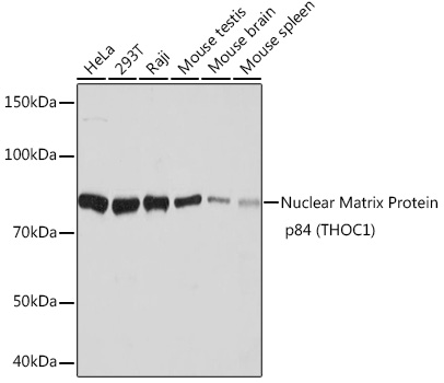 Nuclear Matrix Protein p84 (THOC1) Rabbit mAb