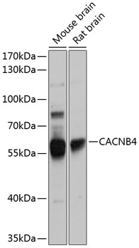 CACNB4 Rabbit pAb