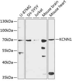 KCNN1 Rabbit pAb