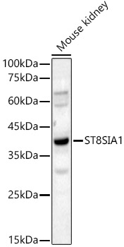 ST8SIA1 Rabbit pAb
