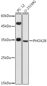 PHOX2B Rabbit pAb