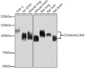 CD166/ALCAM Rabbit mAb