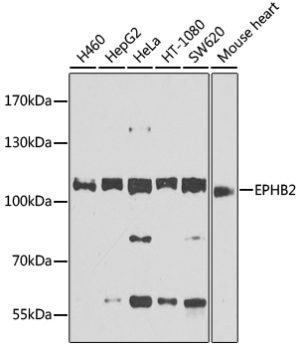 EPHB2 Rabbit pAb