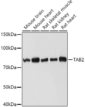 TAB2 Rabbit pAb