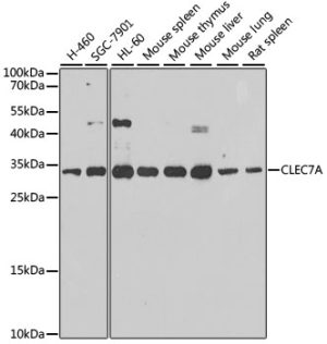 CLEC7A Rabbit pAb