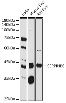 SERPINB6 Rabbit pAb