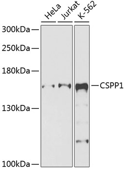 CSPP1 Rabbit pAb