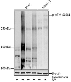 Phospho-ATM-S1981 Rabbit pAb