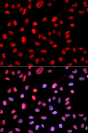 Phospho-DNMT1-S714 Rabbit pAb