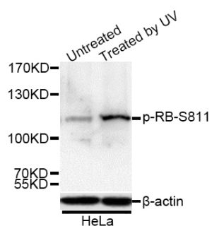 Phospho-RB-S811 Rabbit pAb