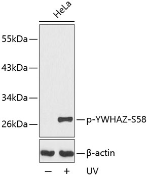 Phospho-YWHAZ-S58 Rabbit pAb