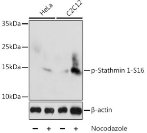 Phospho-Stathmin 1-S16 Rabbit pAb