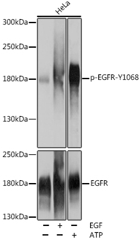 Phospho-EGFR-Y1068 Rabbit pAb