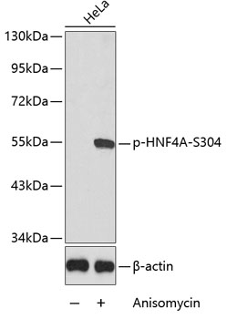 Phospho-HNF4A-S304 Rabbit pAb