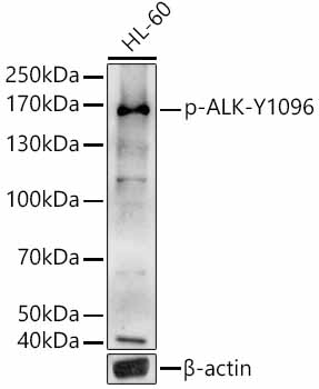 Phospho-ALK-Y1096 Rabbit pAb