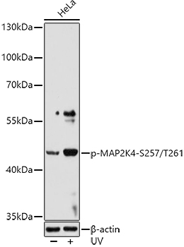 Phospho-MAP2K4-S257/T261 Rabbit pAb