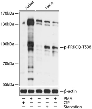 Phospho-PRKCQ-T538 Rabbit pAb