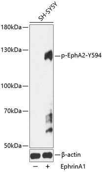Phospho-EPHA2-Y594 Rabbit pAb