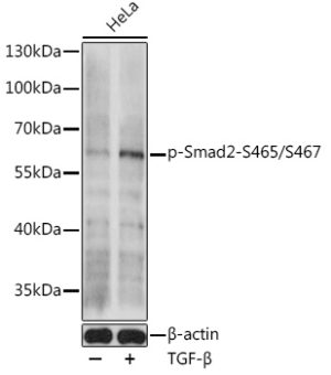 Phospho-Smad2-S465/S467 Rabbit pAb