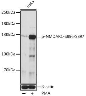 Phospho-NMDAR1-S896/S897 Rabbit pAb