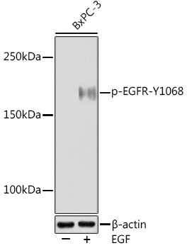 Phospho-EGFR-Y1068 Rabbit mAb