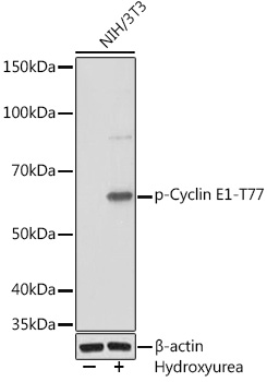 Phospho-Cyclin E1-T77 Rabbit mAb