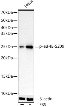 Phospho-eIF4E-S209 Rabbit mAb