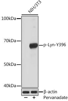 Phospho-Lyn-Y396 Rabbit mAb