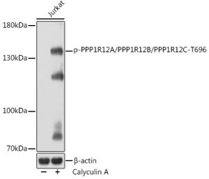Phospho-PPP1R12A/PPP1R12B/PPP1R12C-T696 Rabbit pAb