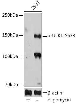 Phospho-ULK1-S638 Rabbit pAb