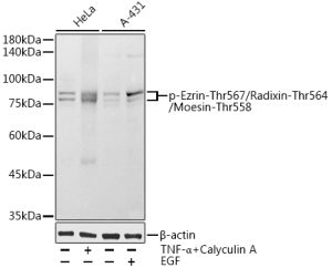 Phospho-Ezrin-Thr567/Radixin-Thr564/Moesin-Thr558 Rabbit pAb