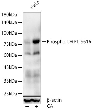Phospho-DRP1-S616 Rabbit mAb