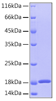 Recombinant Human GMF-Beta/GMFB Protein