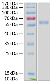 Recombinant Human NKG2D ligand 3/ULBP3 Protein