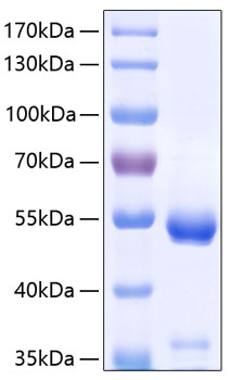 Recombinant Human Carboxypeptidase E/CPE Protein