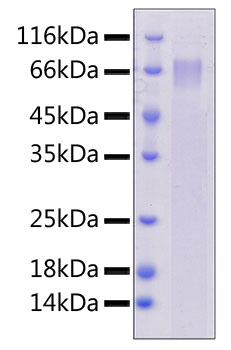Recombinant Human DLL4 Protein