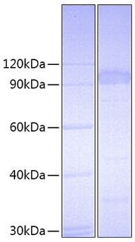 Recombinant Mouse IL-23R Protein