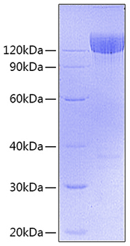 Recombinant Mouse PDGFR-alpha/CD140a Protein