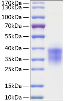 Recombinant Human TWSG1 Protein