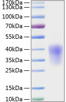 Recombinant Rat CCL2/MCP-1 Protein