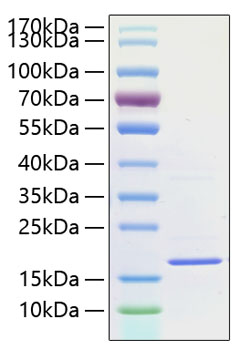 Recombinant Human IL-38/IL-1F10 Protein