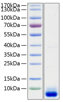 Recombinant Human Complement C5A Protein