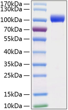 Recombinant Mouse MMP-9 Protein