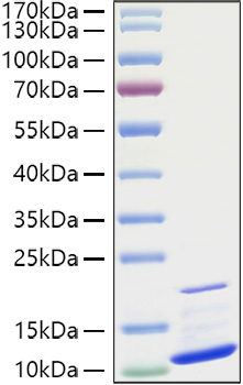 Recombinant Human CXCL3/GRO-gamma/MIP2-beta Protein