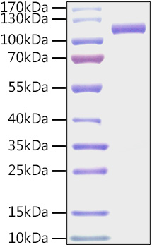 Recombinant Mouse CDCP1/gp140/CD318 Protein