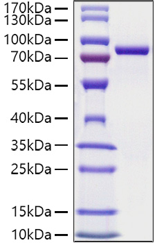 Recombinant Mouse Transferrin/TF Protein