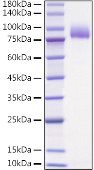 Recombinant Human IL-1 Rrp2/IL-1 R6 Protein