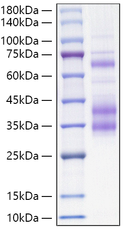 Recombinant Mouse Clusterin/Apo-J/CLU Protein