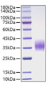 Recombinant Mouse Oncostatin-M/OSM Protein